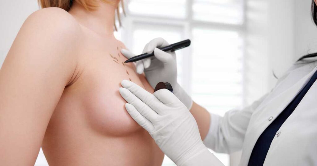 rechazo protesis de mama